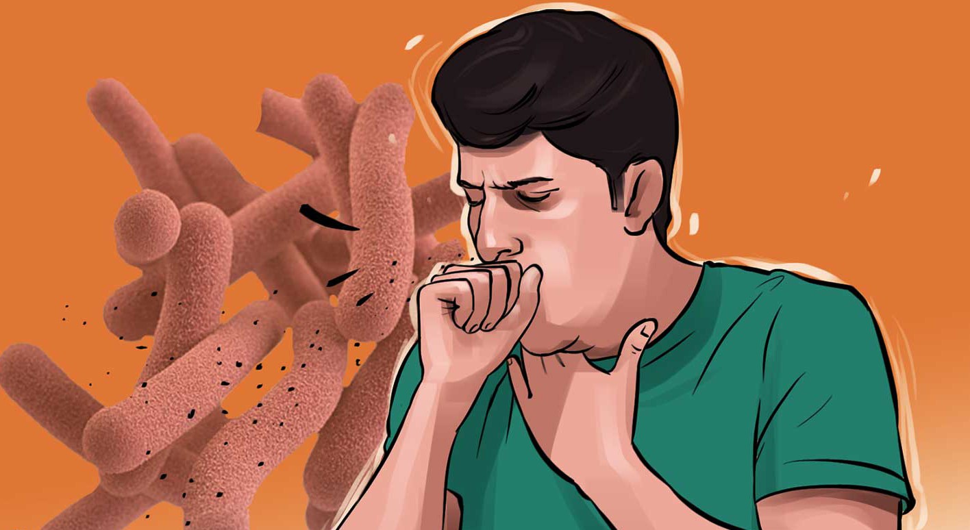 पाल्पामा चालु आवमा १८८ क्षयरोगी